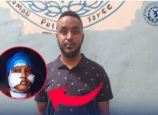 Somali Police Arrest Man for Brutal Assault on Wife in Mogadishu