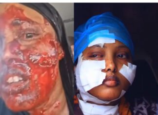 Visa Denial Triggers Brutal Attack on Somali-Dutch Female in Mogadishu