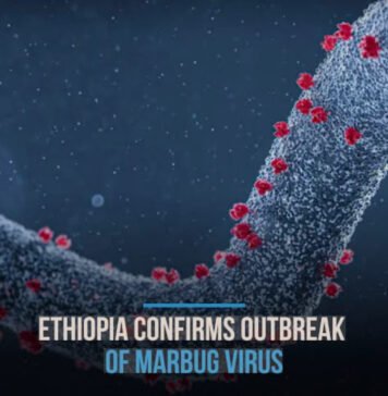 WHO Confirms Deadly Marburg Outbreak in Southern Ethiopia